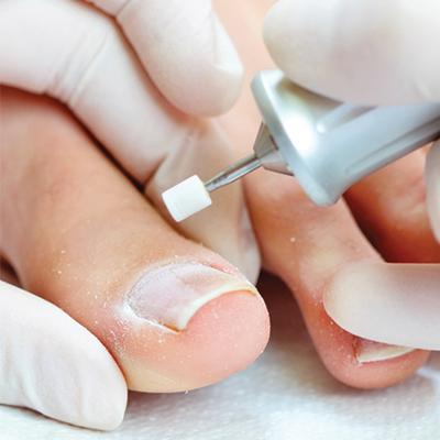 gespecialiseerde voetverzorging